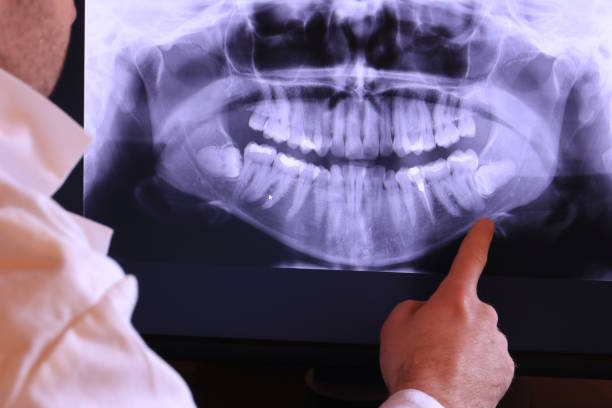 Best Dental Abscess Treatment in Granby, CO